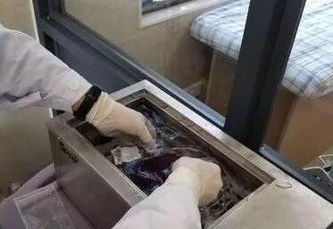 新生儿窒息让脑瘫缠上普通家庭，自存脐带血点燃希望