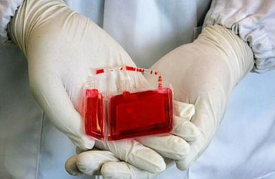 我国自闭症发病率逐年上升，脐带血已用于治疗自闭症