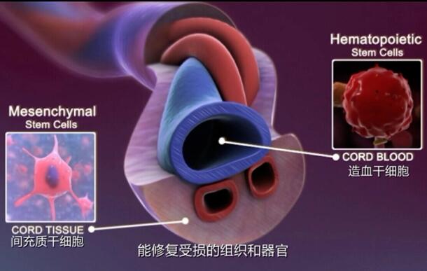 外祖父中风后丧失认知，孙女脐带血干细胞帮他恢复
