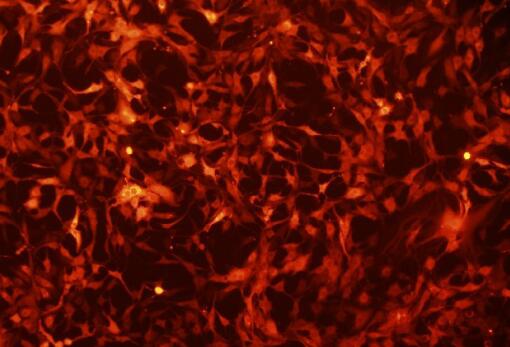 脐带间充质干细胞已成为临床研究的热门种子细胞