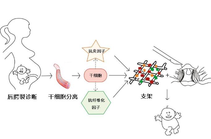 研究证实：脐带血或脐带是唇腭裂治疗中理想的干细胞来源