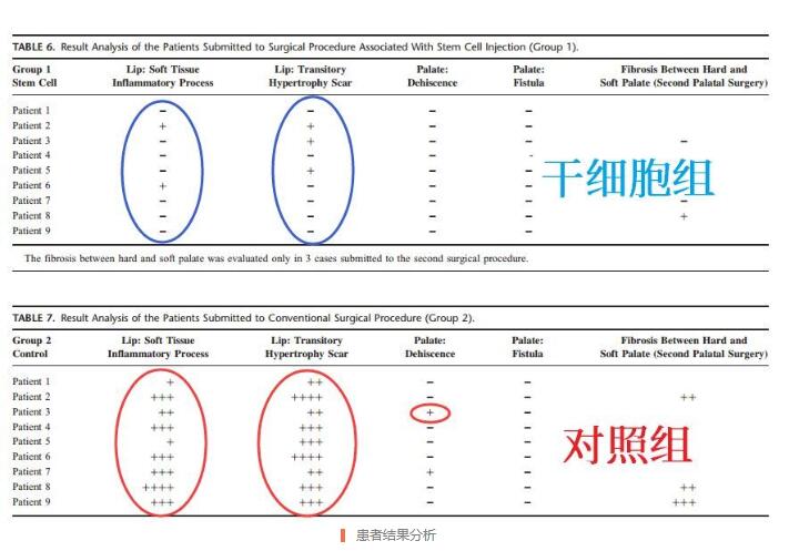 研究证实：脐带血或脐带是唇腭裂治疗中理想的干细胞来源