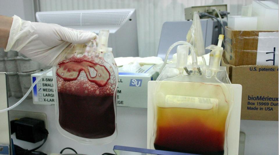 脐带血造血干细胞移植费用是多少(干细胞移植成功率大概多少) 脐带血造血干细胞移植费用是多少(干细胞移植成功率大概多少)